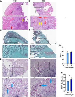 Establishment of a mandible defect model in rabbits infected with multiple bacteria and bioinformatics analysis